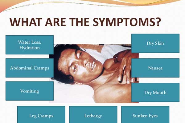 cholera symptoms and signs